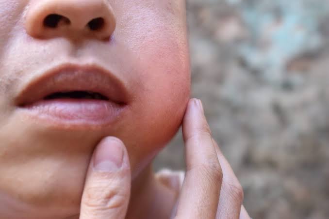 La maladie des cochons - tout ce que vous devez savoir sur les symptômes, le traitement et la prévention